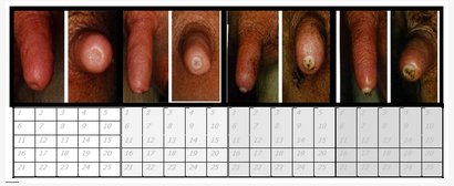 Speenconditie scorekaarten